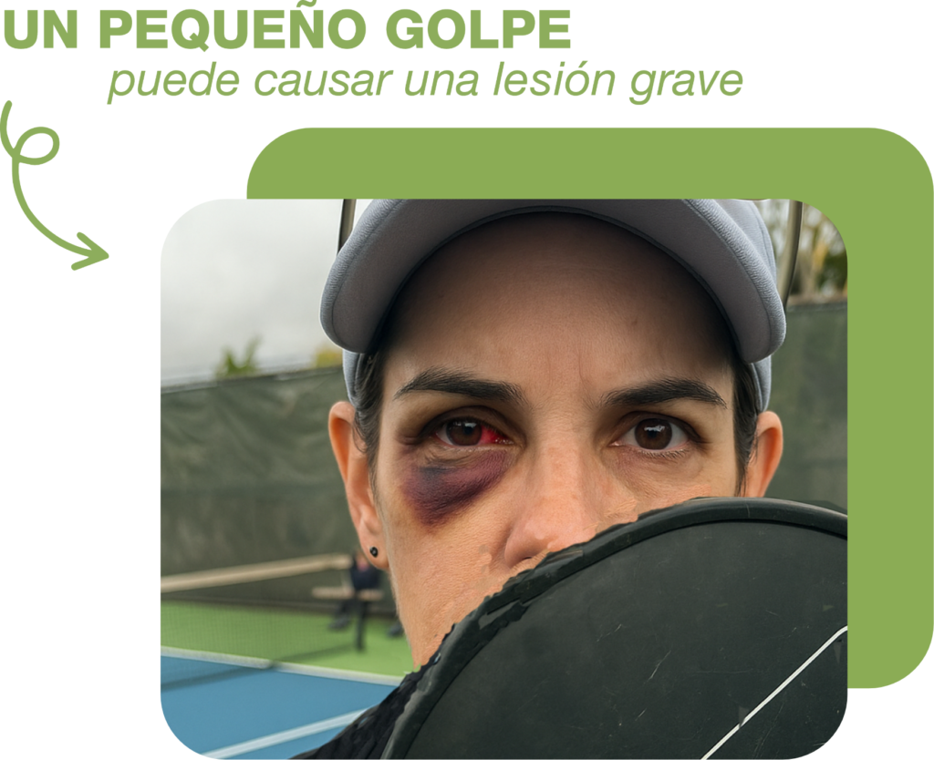 OJUELOS UN SEGUNDO SIN PROTECCION